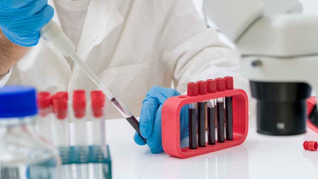Un test de sânge ar putea detecta prezența mutațiilor maligne cu 3 ani înainte de apariția primelor simptome de cancer, arată un studiu